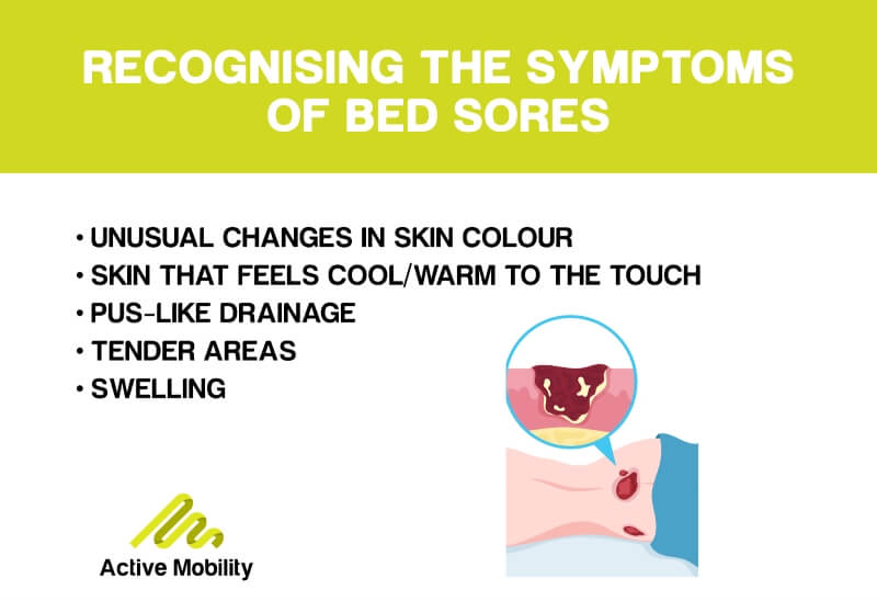Recognising the symptoms of bedsores